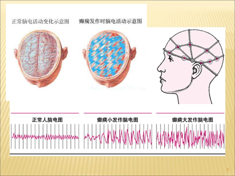 抗癫痫抗惊厥药PPT课件_第3页