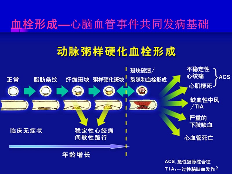 抗血小板药物的临床选择 ppt课件_第2页