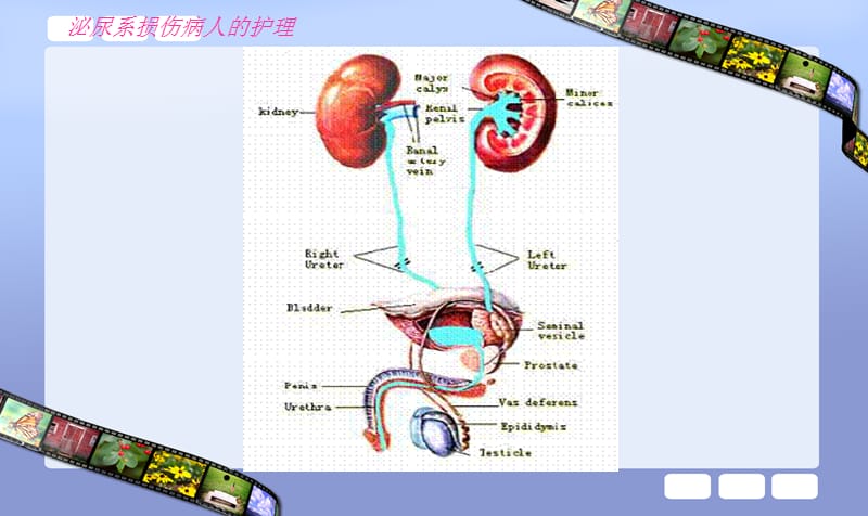 泌尿系统损伤病人的护理 PPT课件_第2页