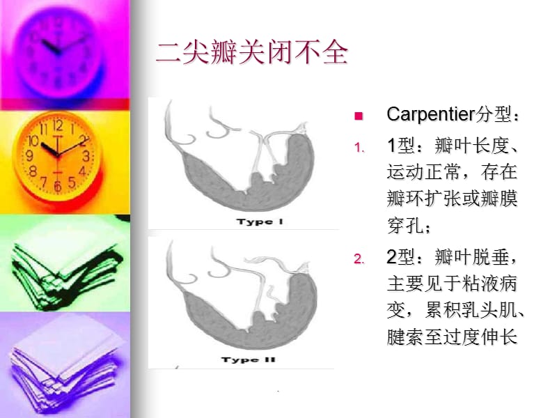 CABG同期二尖瓣成型PPT演示课件_第2页