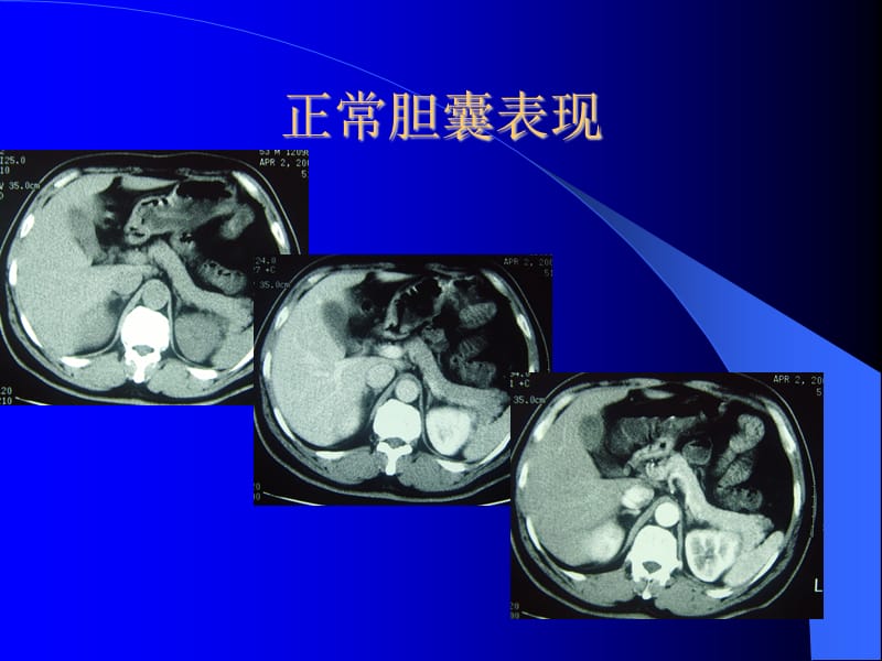 神经调节与体液调节的关系PPT演示课件_第3页