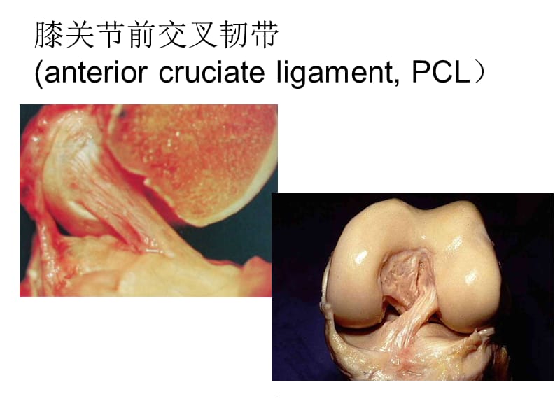 ACL与PCL损伤后的康复程序PPT演示课件_第3页