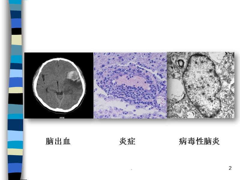 子宫内膜癌NCCN指南解读PPT演示课件_第2页