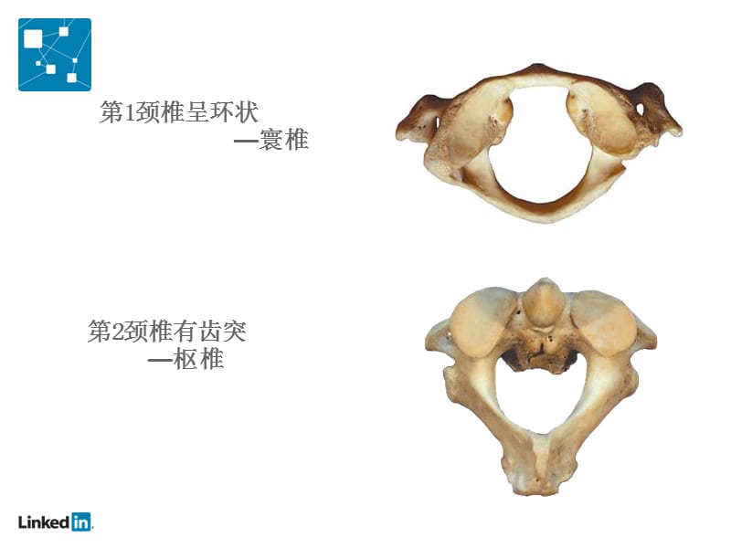 被让颈椎病降低你的工作效率PPT课件_第2页