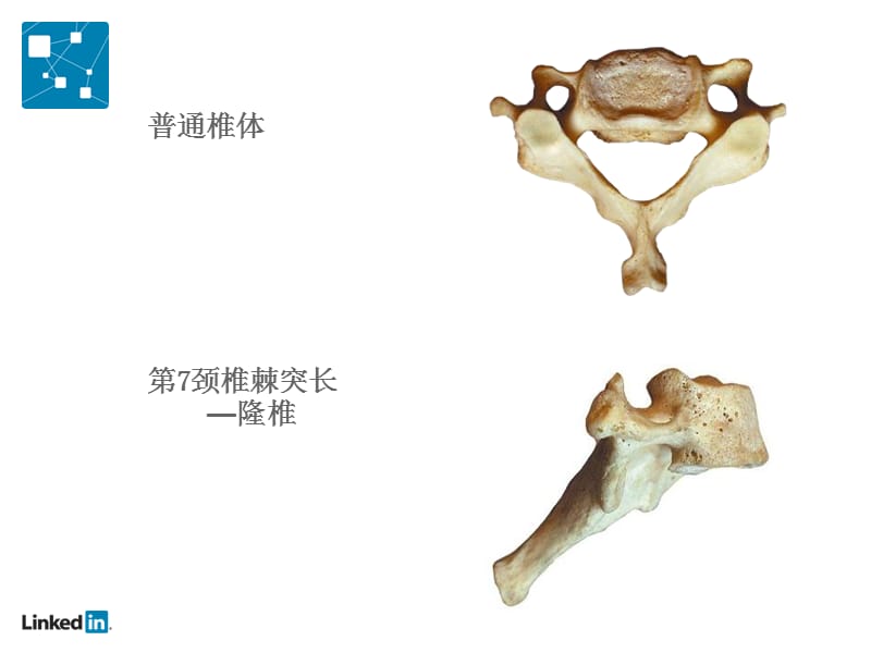 被让颈椎病降低你的工作效率PPT课件_第3页