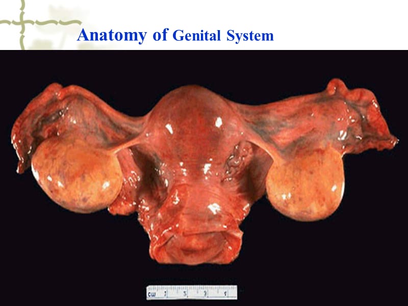 病理学生殖系统疾病医学PPT_第3页