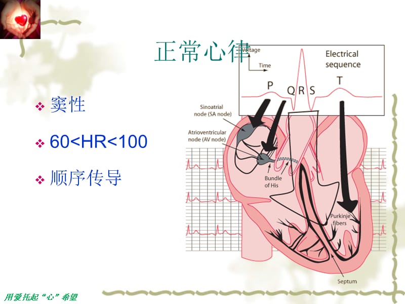 常见心律失常的识别与处理PPT课件_第3页