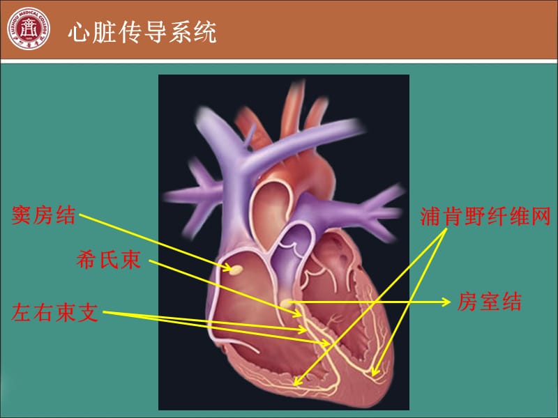 常见心律失常的心电图诊断医学PPT_第2页