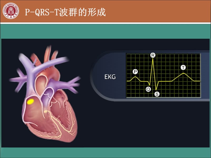 常见心律失常的心电图诊断医学PPT_第3页