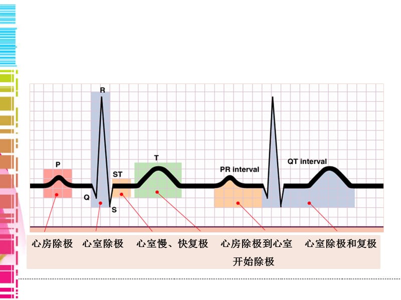 常见心律失常PPT课件_第2页