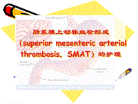 肠系膜上动脉血栓形成的护理PPT课件