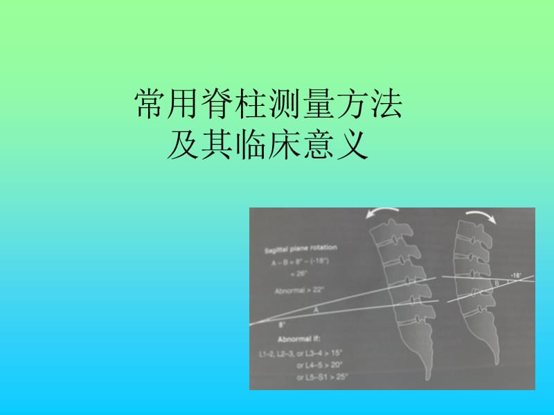 常用脊柱测量方法及其临床意义医学PPT_第1页