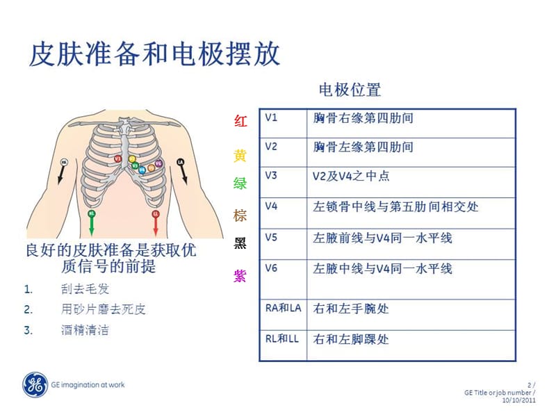 常见心律失常的识别与处理医学PPT_第3页