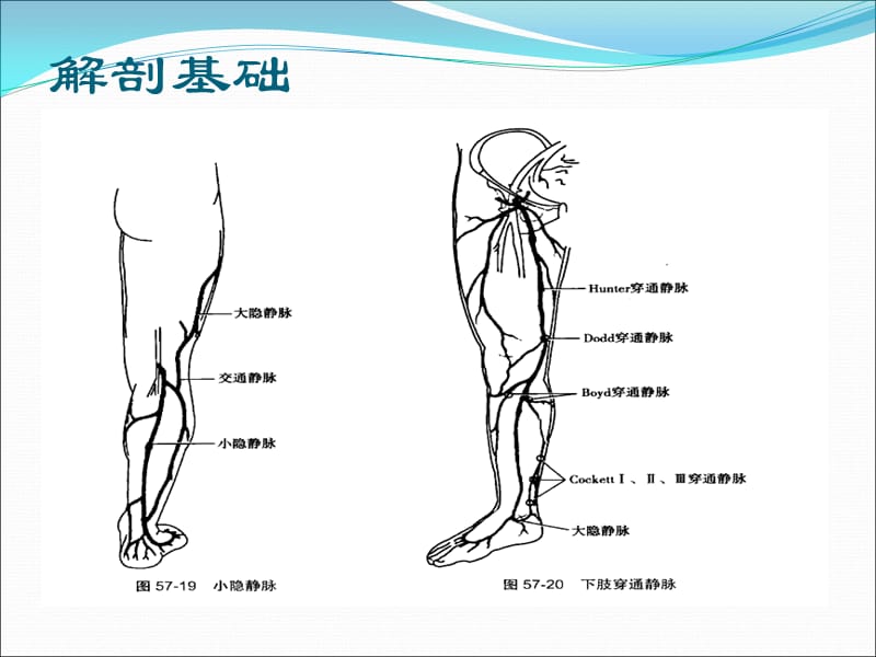 单纯性下肢静脉曲张医学PPTPPT课件_第3页