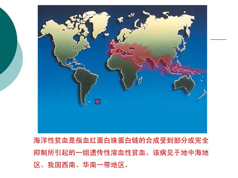 地贫内分泌并发症医学PPT_第2页