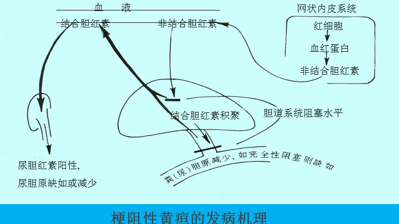 胆汁淤积性疾病病理研究进展及防治医学PPT_第3页