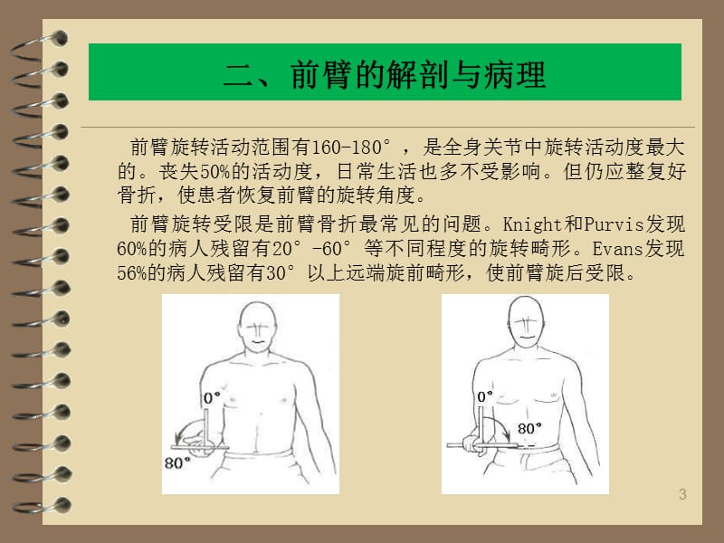 儿童前臂双骨折单骨固定ppt课件_第3页