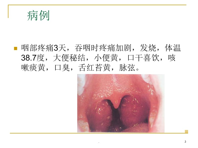 乳  蛾-PPT演示课件_第3页