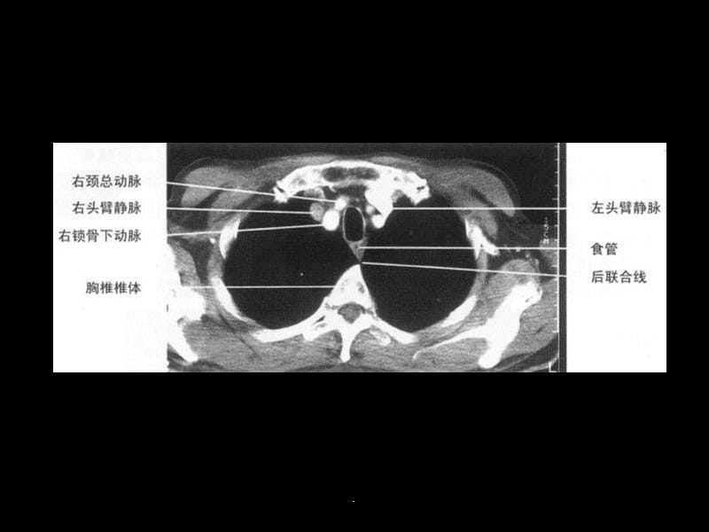 超声肝胆胰脾PPT演示课件_第2页