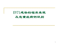 EV71感染的臨床表現(xiàn)及危重癥病例識(shí)別 ppt課件