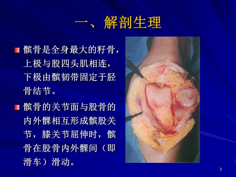 髌骨软化症的诊断及治疗PPT课件_第3页