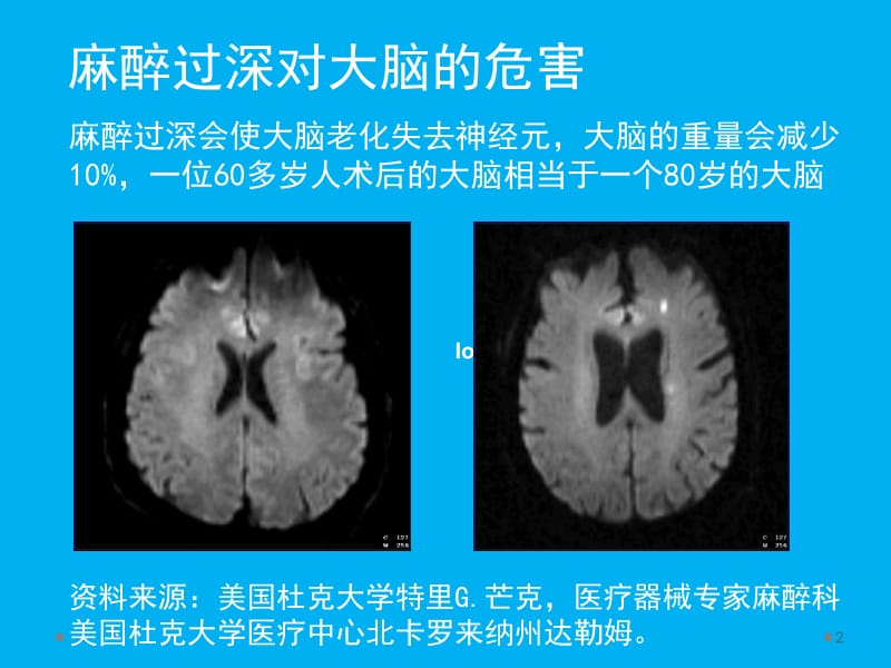 脑电麻醉深度参数与临床运用ppt课件_第2页