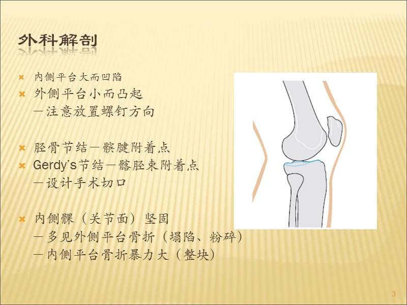 胫骨平台骨折诊断PPT课件_第3页