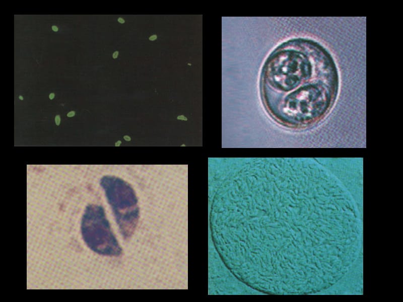 机会致病性原虫 ppt课件_第3页