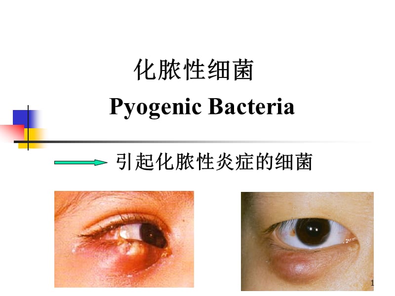 化脓菌ppt课件_第1页