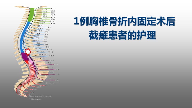 脊髓损伤个案 ppt课件_第2页