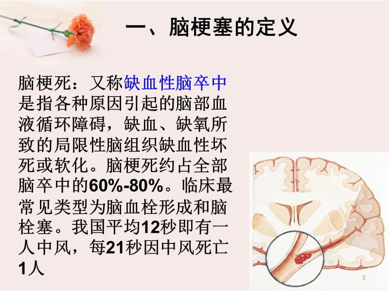 急性脑梗塞溶栓治疗护理ppt课件_第2页