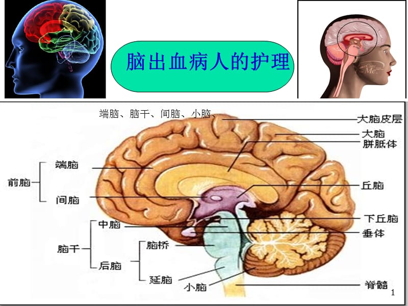 脑出血的护理PPT课件_第1页