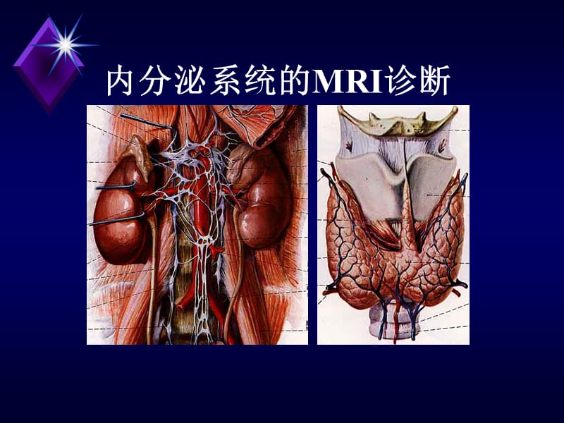 内分泌系统疾病的MRI诊断PPT演示课件_第1页