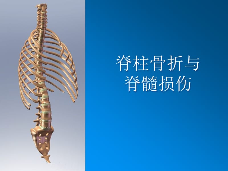 脊柱骨折和脊髓损伤PPT课件_第1页
