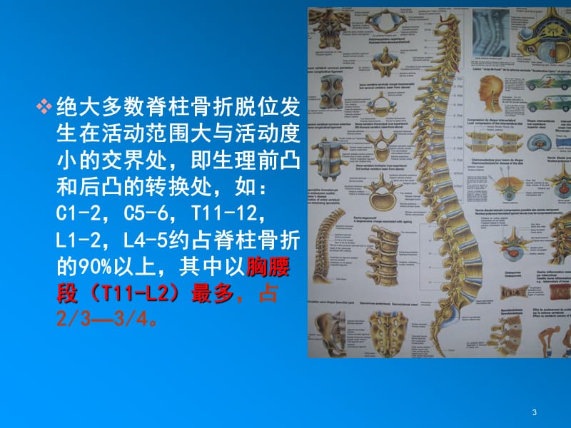 脊柱骨折和脊髓损伤PPT课件_第3页