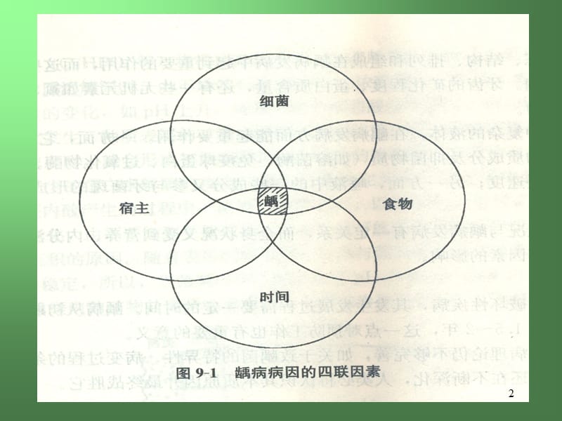 龋病病因学PPT课件_第2页