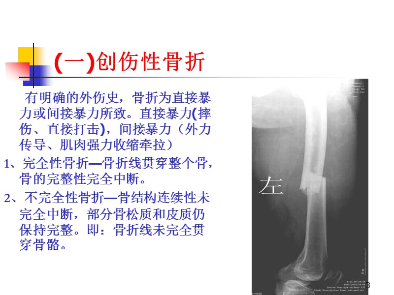 骨关节损伤ppt课件_第3页