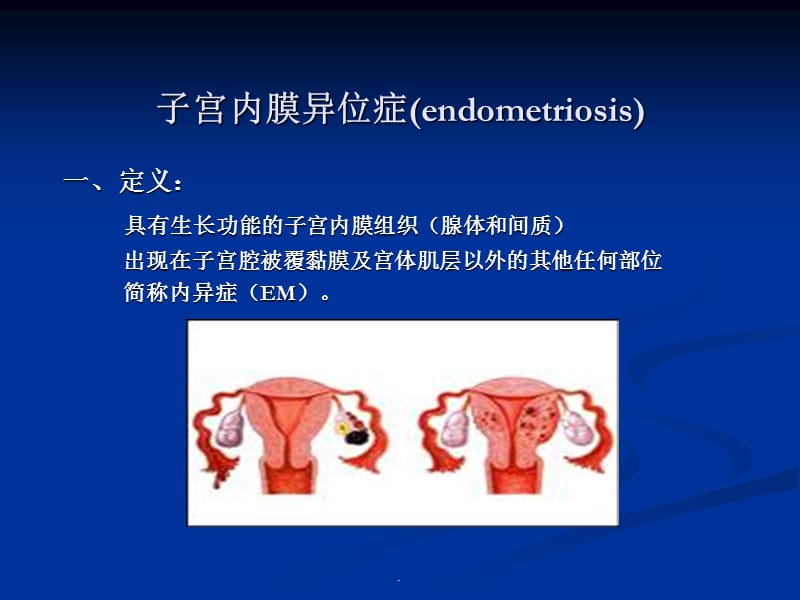子宫内膜异位症和子宫PPT演示课件_第3页