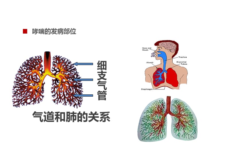 儿童哮喘防治课件PPT演示课件_第3页