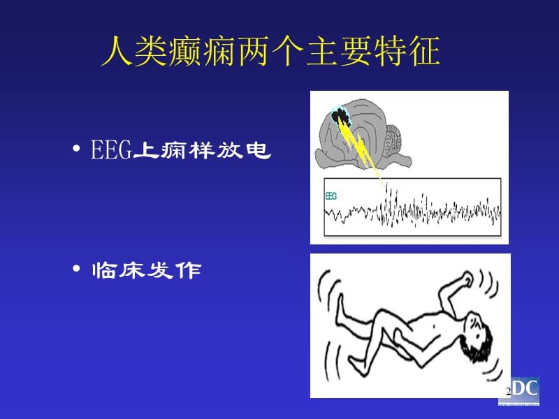 癫痫发作的鉴别诊断 ppt课件_第2页