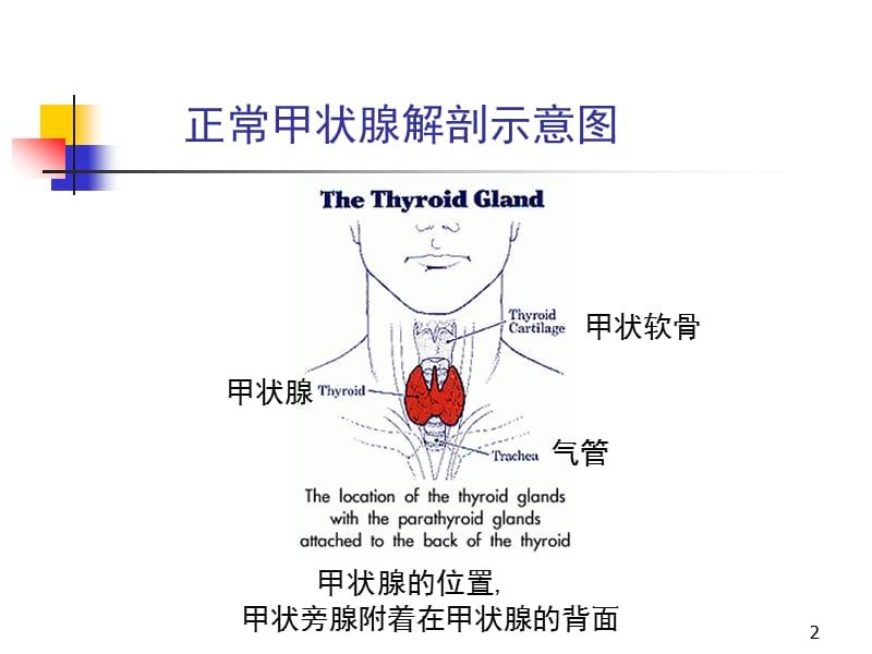 甲亢的特殊表现及处理 ppt课件_第2页