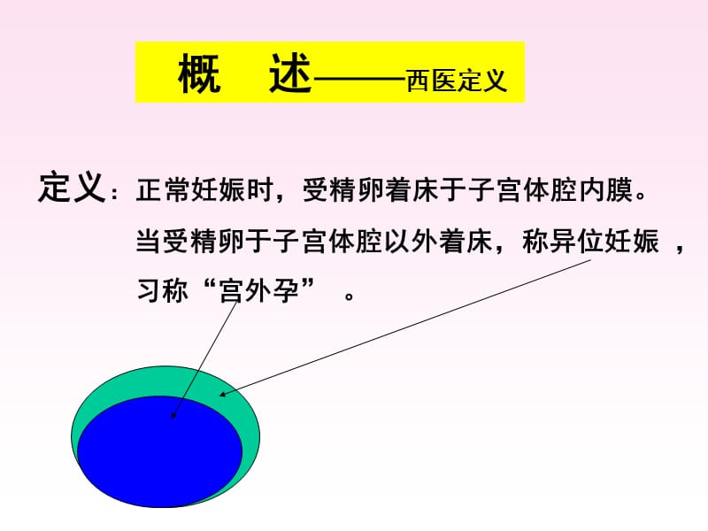 异位妊娠PPT演示课件_第3页