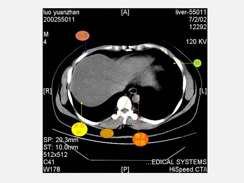 腹部X线诊断PPT演示课件_第2页
