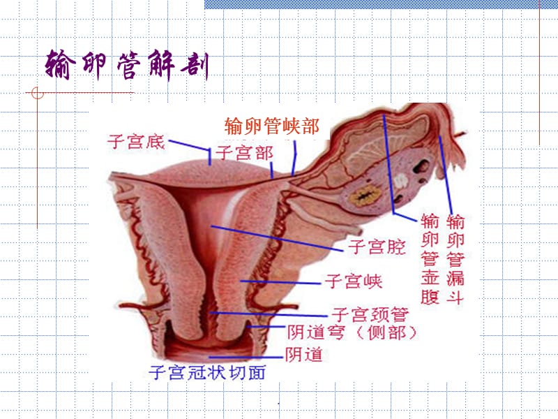 子宫造影PPT演示课件_第3页