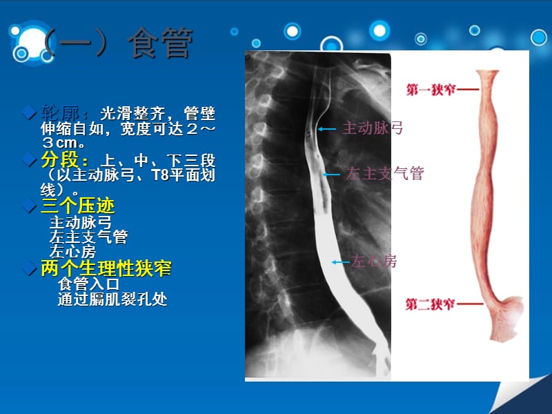 消化道正常、异常征象PPT演示课件_第3页