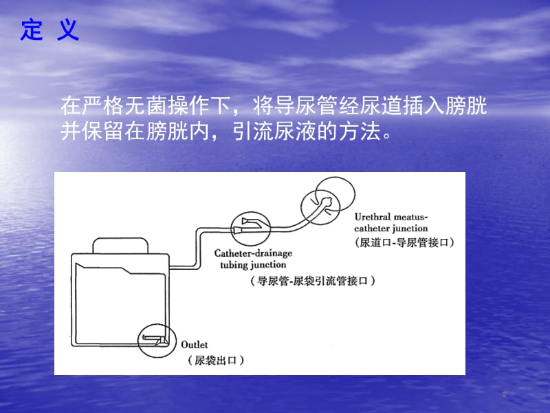 留置尿管漏尿原因分析及处理 ppt课件_第2页