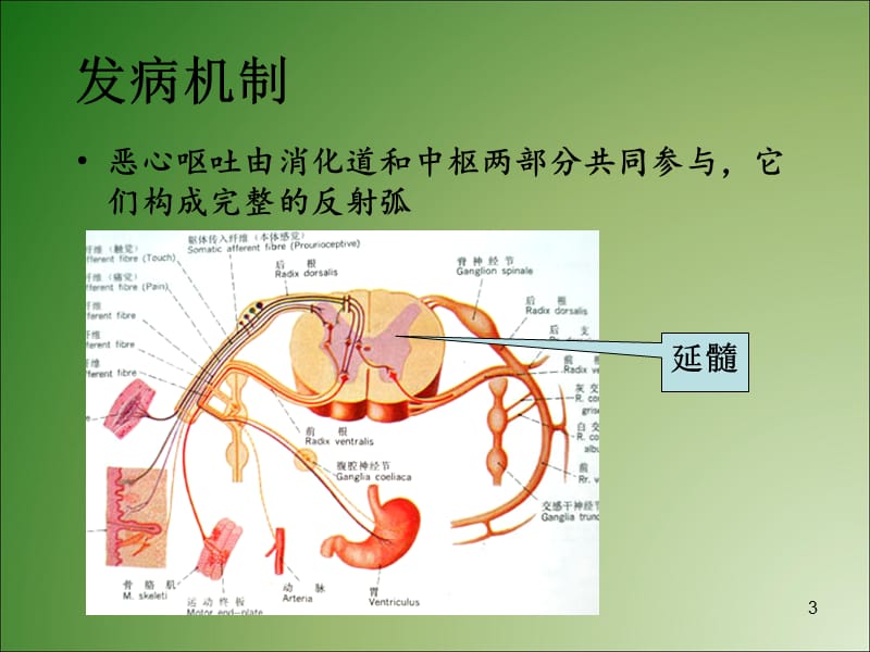 呕吐诊断与鉴别ppt课件_第3页