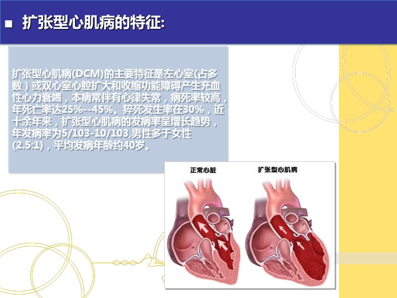 扩张型心肌病的治疗与护理 ppt课件_第2页