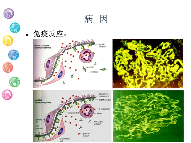 泌尿系统肾小球疾病PPT课件_第3页