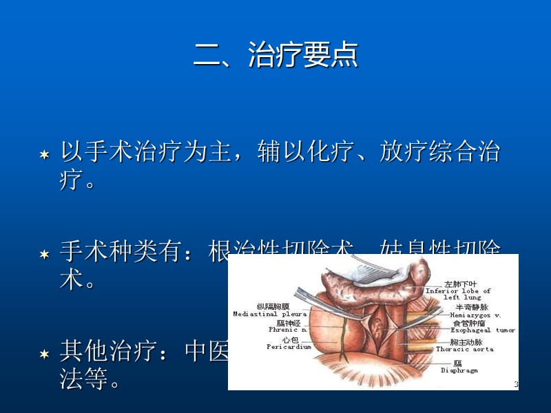 食管癌术后饮食护理要点 ppt课件_第3页